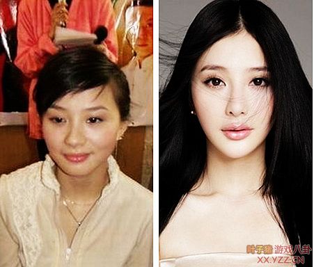 娱乐圈女明星大饼脸惊变锥子